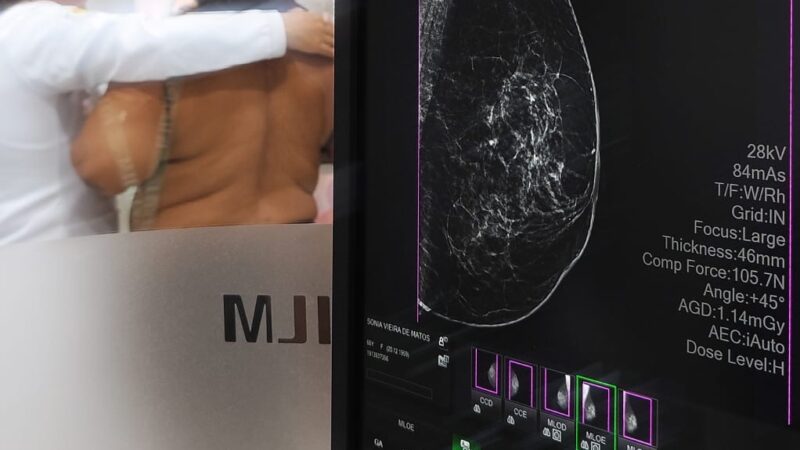 Prefeitura de Itabuna reforça a importância da prevenção e do cuidado com a saúde da mulher no Outubro Rosa
